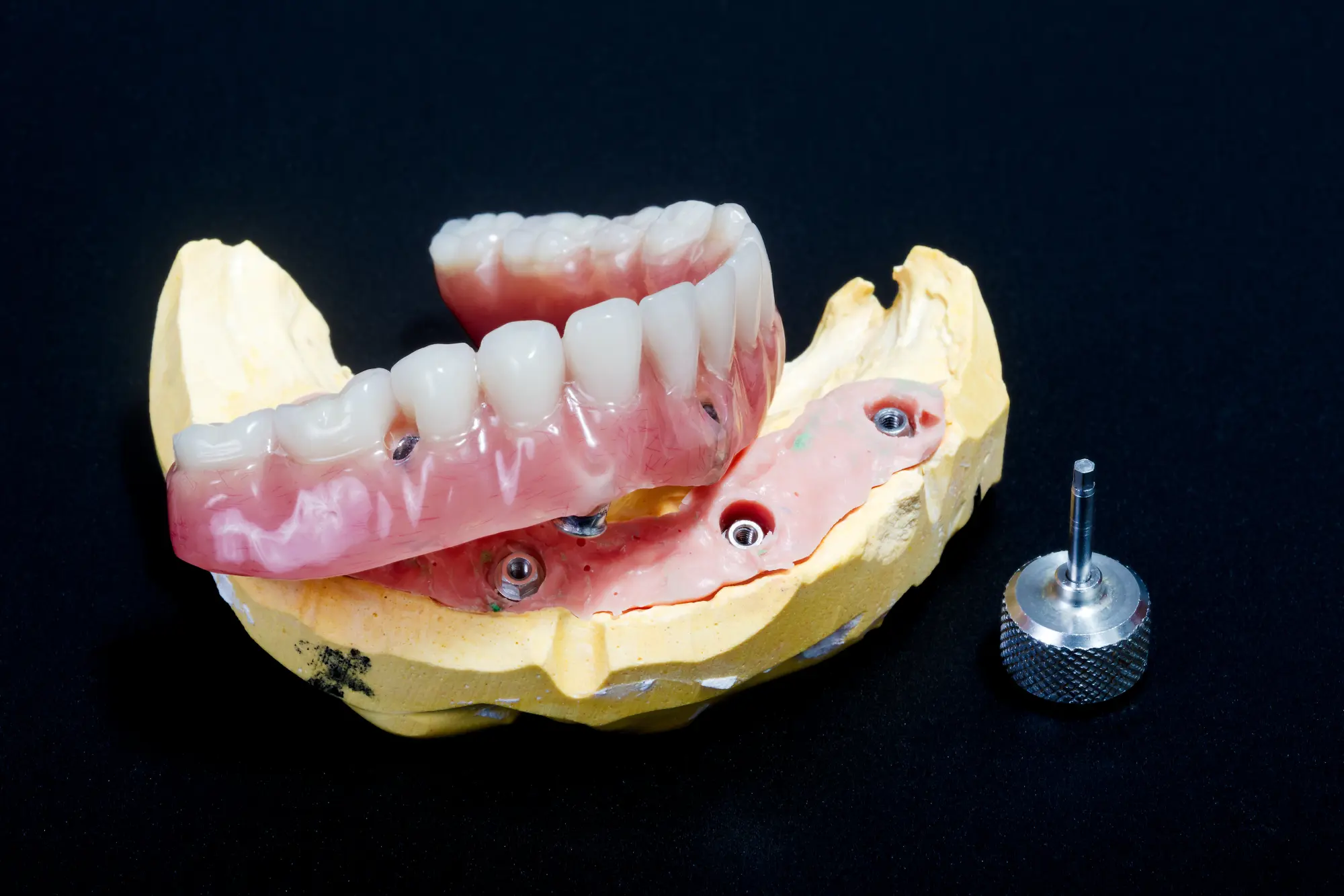Confident smile after full arch dentistry